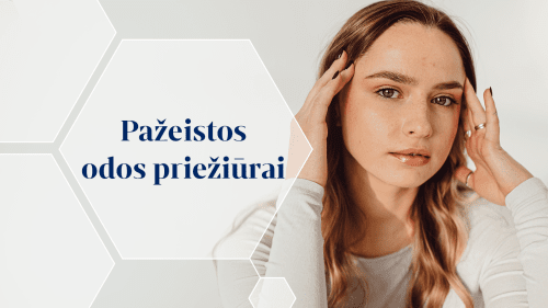 PAŽEISTOS ODOS PRIEŽIŪRAI